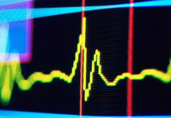Технології - Ритм у пульсі людини може сигналізувати про майбутнє когнітивне погіршення