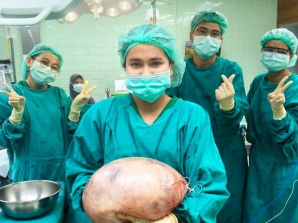 Новини світу - В Таїланді лікарі видалили 8-кілограмову кісту