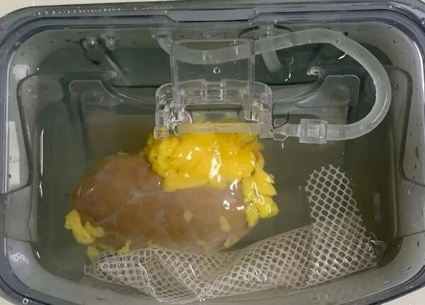 Технології - Науковці вперше створили "універсальну" нирку для трансплантації