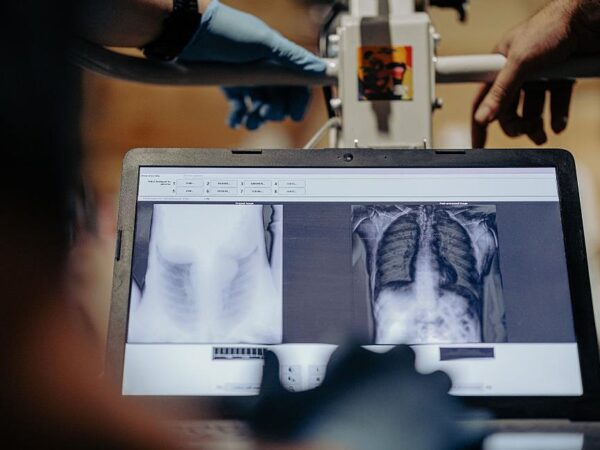 Новини України - У ЗСУ цифровізують медицину - Сирський