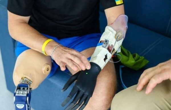 Новини світу - Ісландія виділяє $11,6 млн на протезування українських бійців