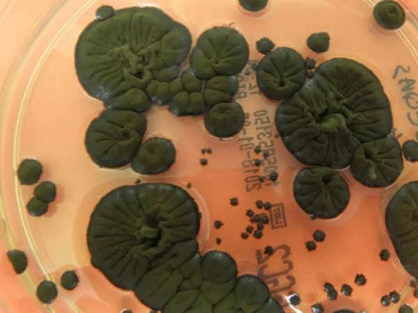 Технології - NASA розглядає чорнобильські гриби як новий захист від радіації в космосі